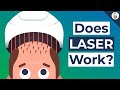 Is Laser Therapy Effective For Hair Loss?