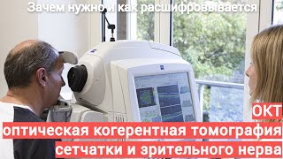 ОКТ оптическая когерентная томография сетчатки и зрительного нерва   зачем нужна, как расшифровывает