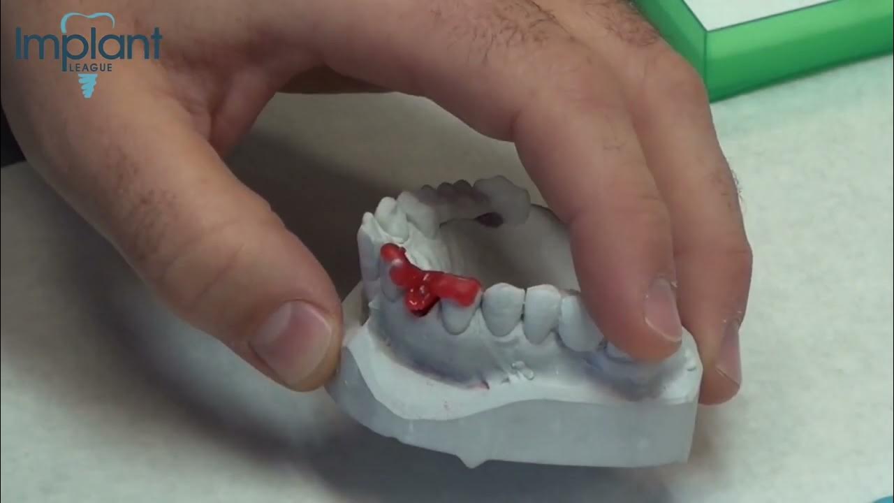 how to transfer the abutment from cast by abutment jig implant course