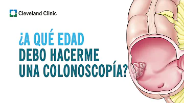 ¿Con qué frecuencia deben hacerse una colonoscopia los pacientes de Crohn?