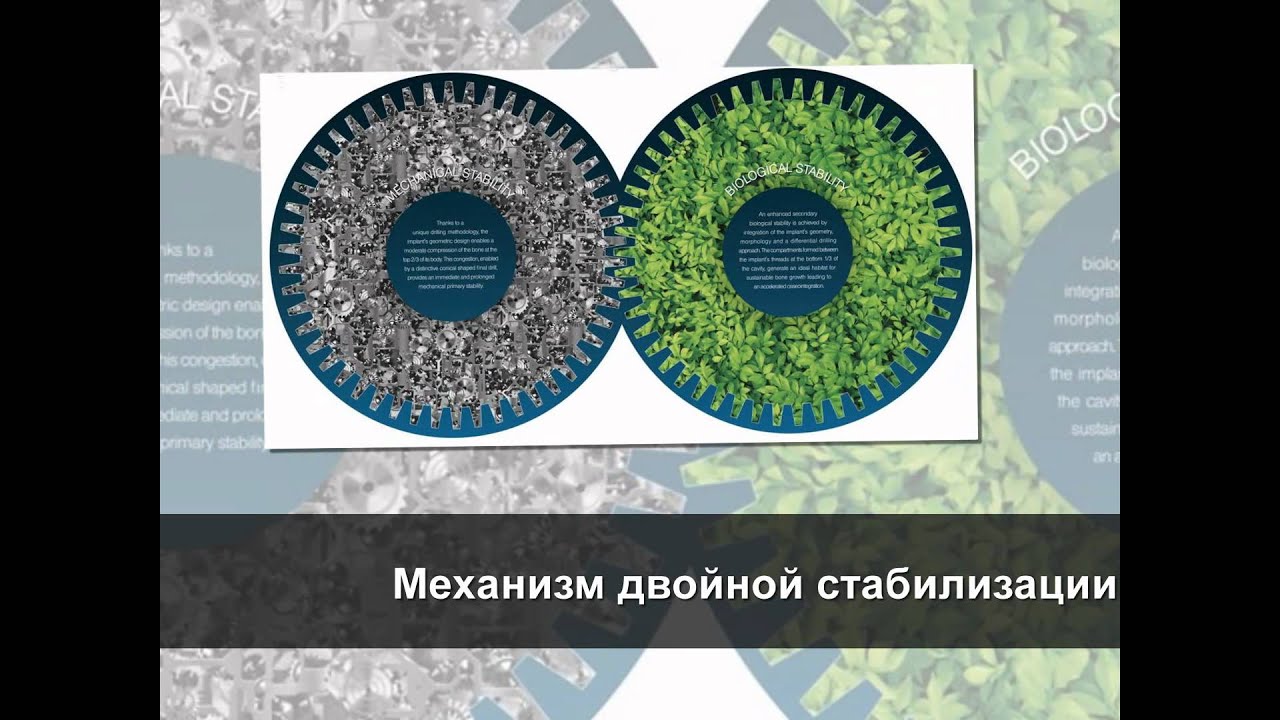 C1: New implant by MIS implant training in chennai for cse