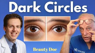 Best Treatments for Dark Circles Under Eyes by Dr. Kopelman 706 views 12 days ago 35 minutes