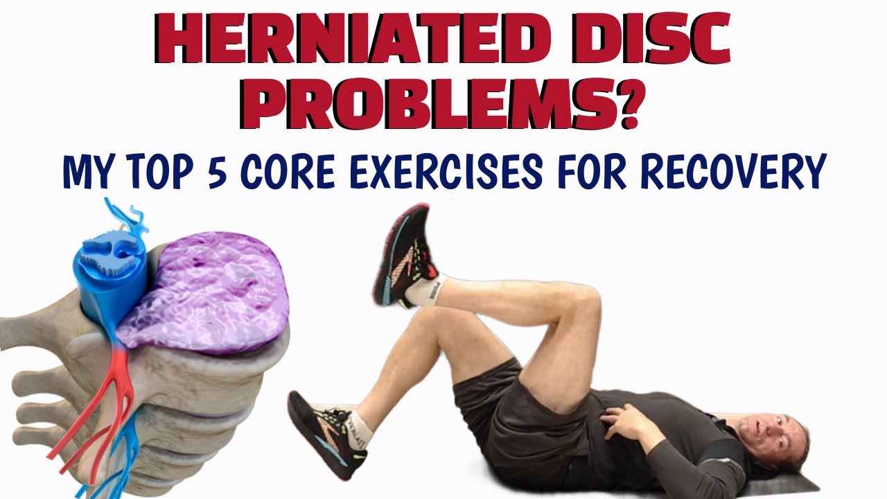 Safe Herniated Disc Exercises For Recovery - YouTube