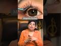 Side effect of Magnetic Eyelashes | best Dermatologist in Delhi | DMC | #shorts #youtubeshorts