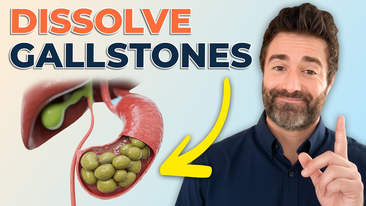 How to Get Rid of Gallstones Naturally thumbnail
