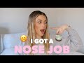 MY NOSE JOB | My Story, Before + After, Do I Regret It?