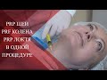 💉PRP терапия в косметологии и травматологии| Мой опыт применения PRF методики при патологии суставов