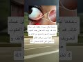 عندما تبكي يحدث ضغط علئ عينك لذلك قد اوجد الله تعالئ هذه الثقوب لتصريف الدموع لتخرج من الأنف و عندما تبكي يحدث ضغط علئ عينك لذلك قد اوجد الله تعالئ هذه الثقوب لتصريف الدموع لتخرج من الأنف و