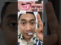 BERAPA LAMA WAKTU PASANG GIGI PALSU SETELAH CABUT GIGI #pasanggigipalsu #setelahcabutgigi