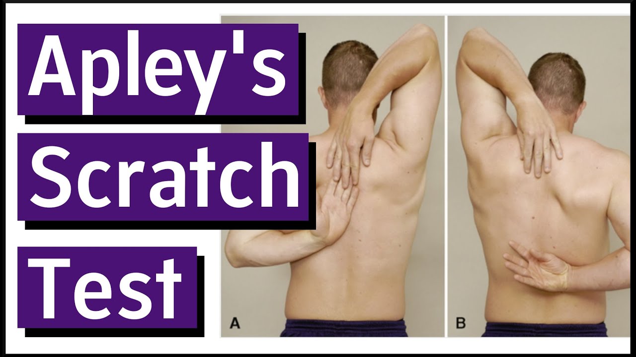 Apleys Scratch Test | Shoulder Range of Motion & Scapular Dyskinesis