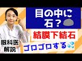 【結膜下結石】まぶたに石ができる？目がゴロゴロする人はチェック！眼科医が解説！