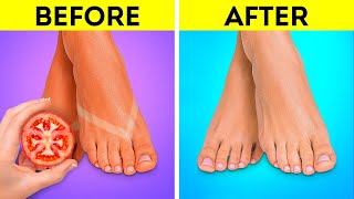 Foot Care Hacks Smart Hacks To Keep Your Feet Nice And Smooth