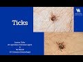 TIcks