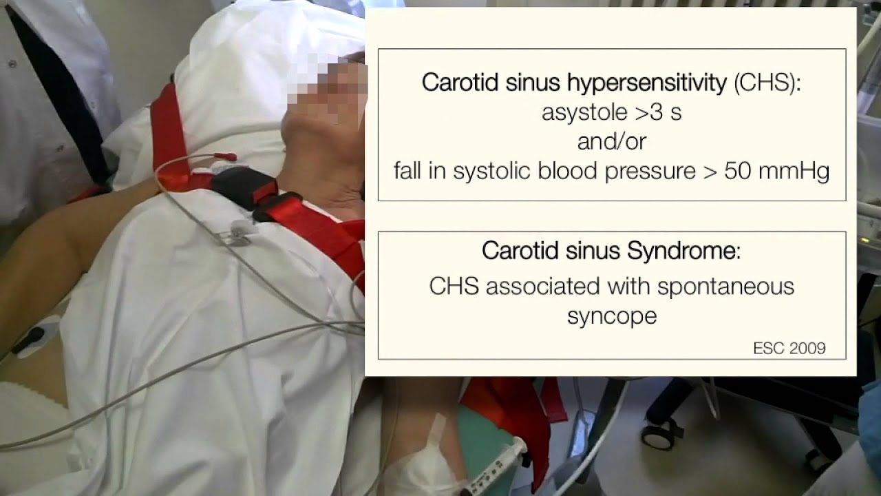 SYNCOPE sinus cardiac massage video YouTube
