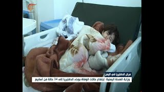 وزارة الصحة اليمنية: إرتفاع حالات الوفاة بوباء الكوليرا