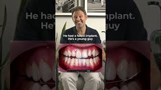 Exposed - Re-Implanted