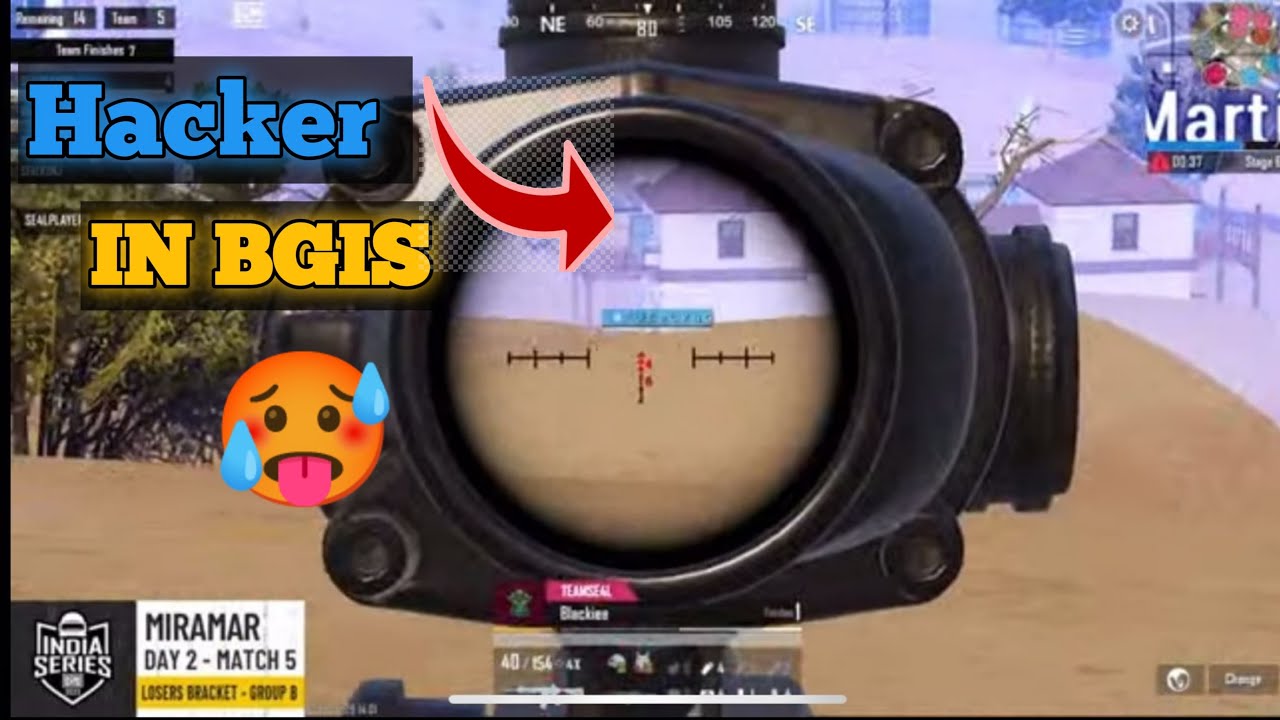 New hacker in bgis losers bracket || everyone shoked || 