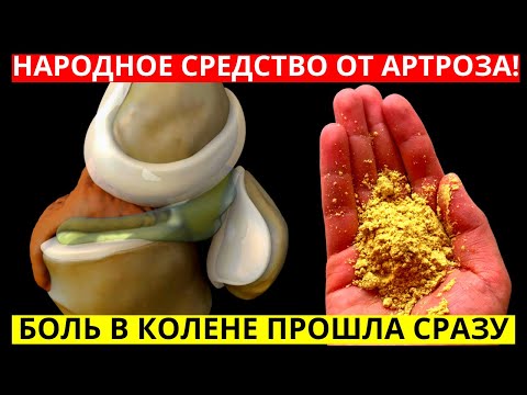 БОЛЬ В КОЛЕНЯХ УШЛА за 2 часа НАРОДНОЕ средство от АРТРОЗА