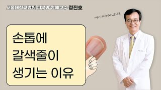Why Brown Lines Appear on Fingernails