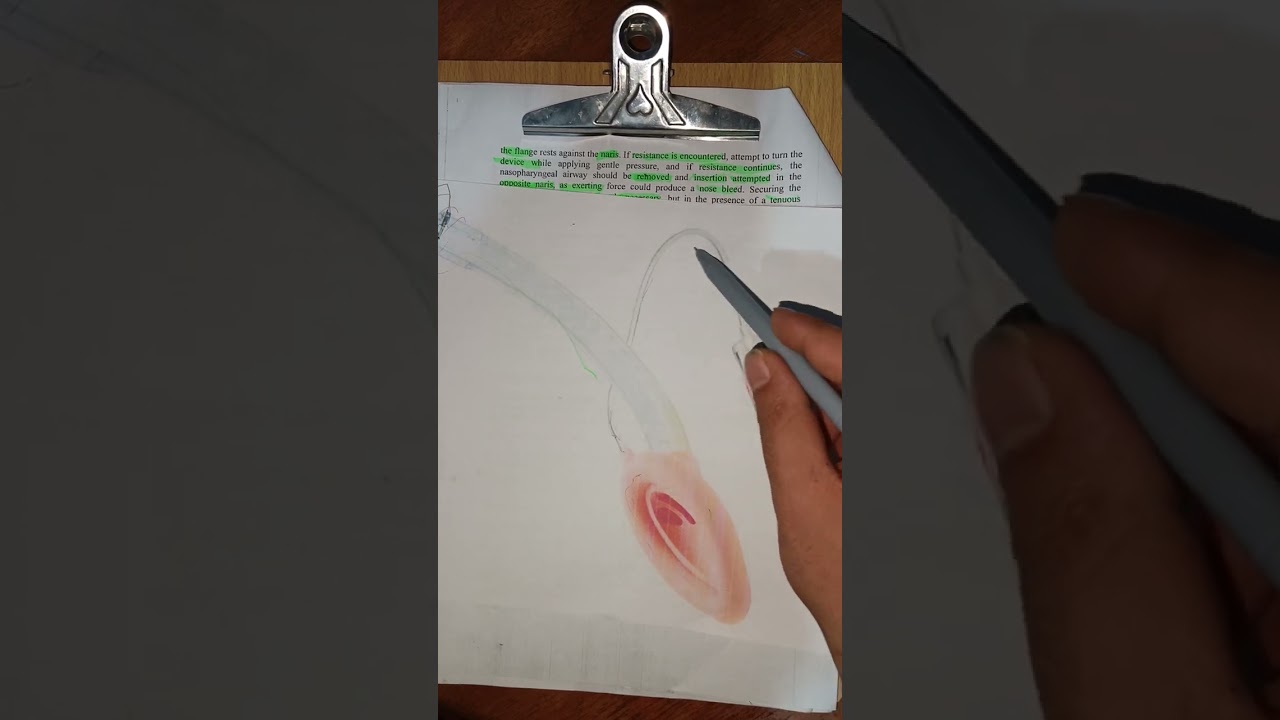 #شرح_وزاري عناية/رابعة Airway Management Of Pediatric جزء ثاني 