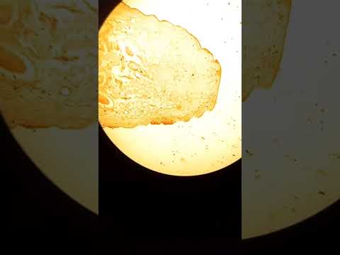 بررسی دقیق تنیا ساژیناتا زیر میکروسکوپ A Closer Look At Tania Saginata Under The Microscope