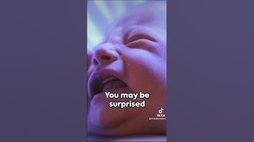 Newborn Jaundice Explained: #NewbornJaundice #BabyHealth #NewbornCare #parenting  #newborn #facts