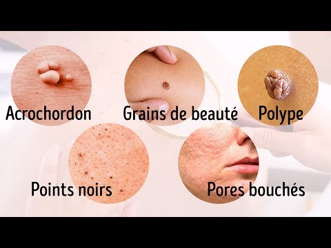 Vidéo: De Quelles Maladies Votre Peau Parlera-t-elle?