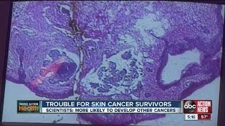 Skin cancer survivors have higher likelihood of getting another form of cancer