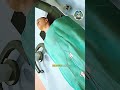 Inside TAVR Procedure ⚡ 3D Heart Animation
