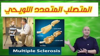 MS|From A to Z |المتصلب المتعدد اللويحي | المتصلب المتناثر | الاسباب والاعراض وطرق التشخيص