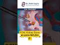 IS PCNL Treatment for Kidney Stones not safe? PCNL से Kidney Stone का इलाज कैसे होता है? #pcnl