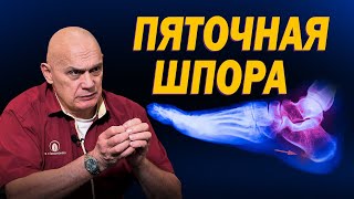 Пяточная шпора: причины, симптомы и последствия. Лучшие способы избавления от боли в пятках