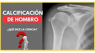 CALCIFICACIÓN DE HOMBRO- ¿Qué es? ¿Cómo se forma? ¿Cómo se diagnostica?