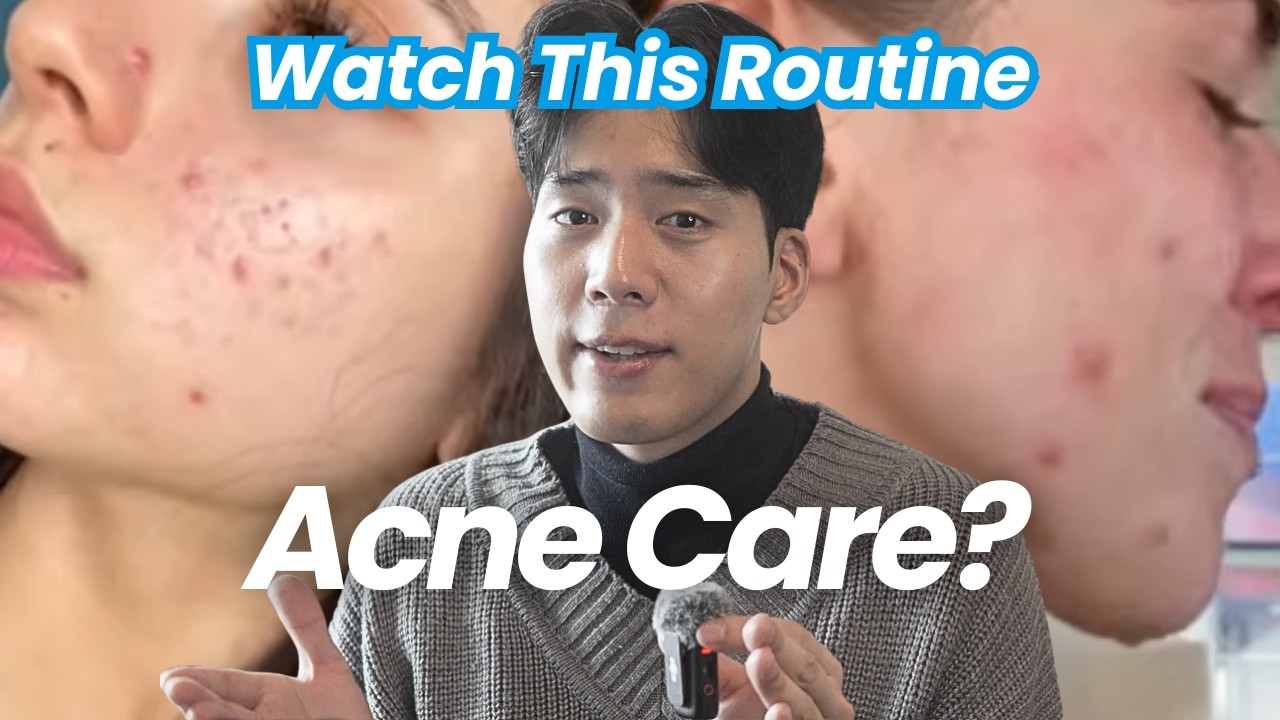 At-Home Pimple and Acne Treatment: 3 Ultimate Ways to Clear Skin (No Tretinoin / No Accutane)