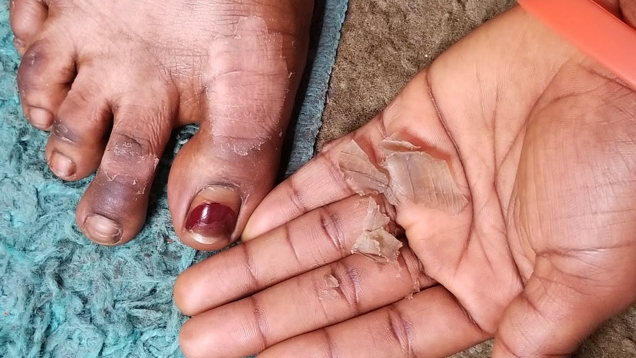 HERBAL MIRACLE SOAP IS BACK IN STOCK AGAIN