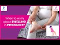 Pregnancy Swelling: How to Tell If It’s Normal or High-Risk Sign - Dr.Fareha Khatoon|Doctors' Circle