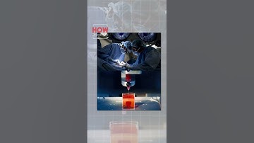 In 3D trái tim người: Tương lai ghép nội tạng?