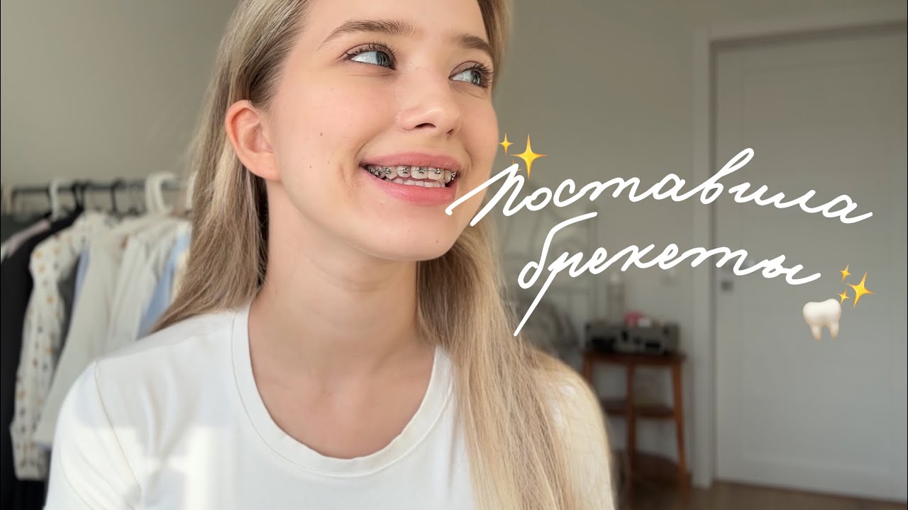 Поставила брекеты | делюсь первыми впечатлениями и сдаю сессию в МГУ