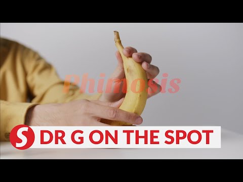 EP60: Living under the shadow of the foreskin | PUTTING DR G ON THE SPOT