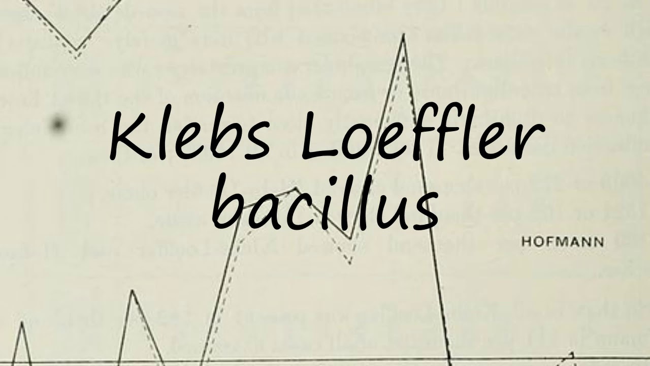 How To Pronounce Loeffler Randall