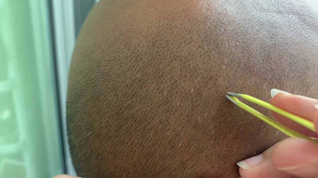 7mins Plucking gray hair ep.1