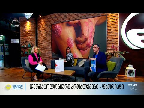 ფსორიაზის გამომწვევი მიზეზები, გამწვავების ეტაპები და მკურნალობის მეთოდები