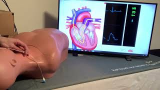 Right Heart Catheterization with Simulab's PacerMan System.