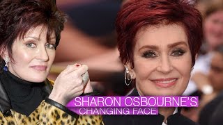Famous Sharon Osbourne's Changing Face Profile