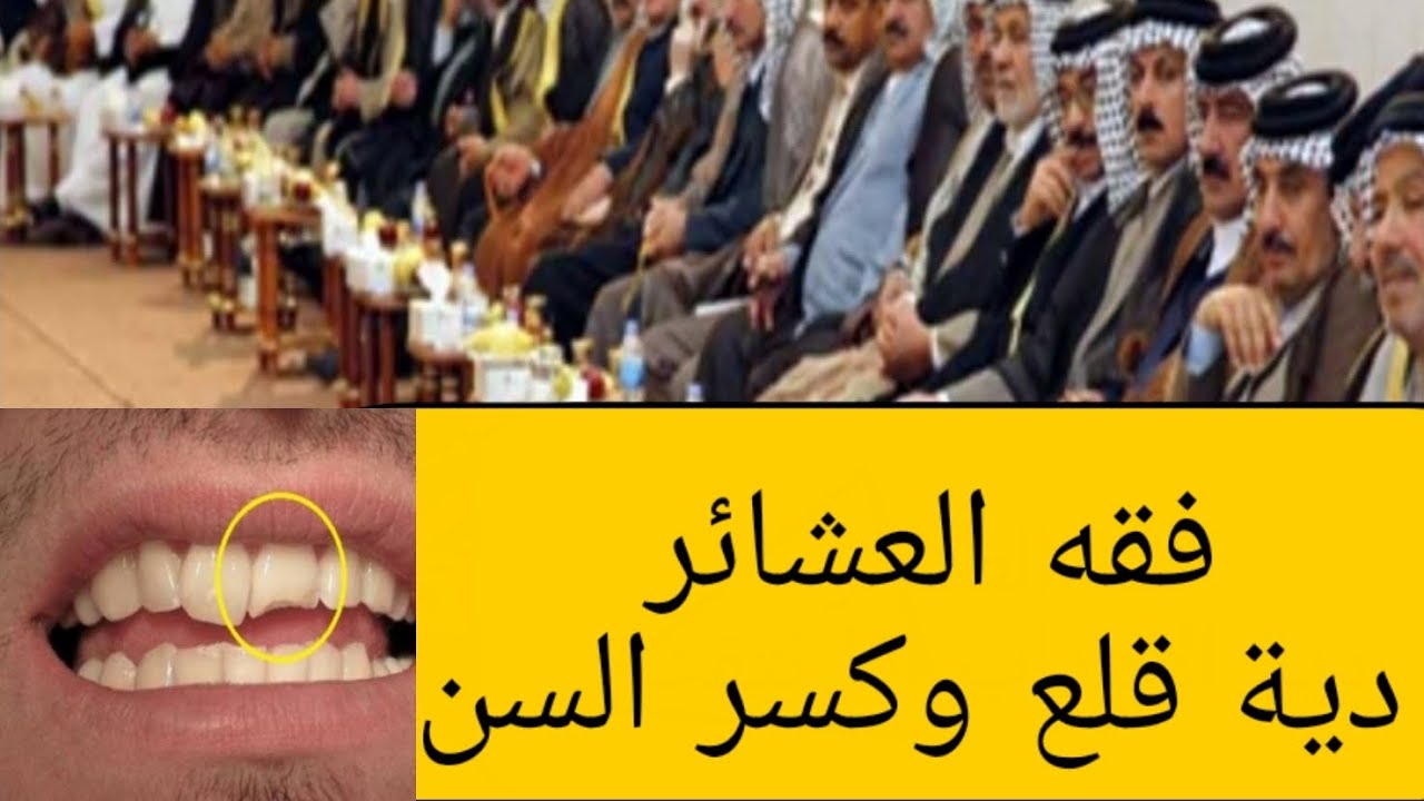 018 فقه العشائر/ دية قلع أو كسر السن