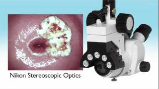 Wallach Zoomscope English