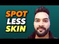 Reduce DARK SPOTS, ACNE/PIMPLES MARKS & BLACK SPOTS Naturally. DIET Explained