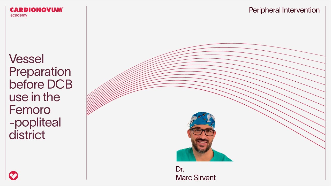 Vessel Preparation before DCB  use in the Femoro-popliteal distric