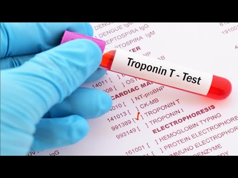 How To Maintain Normal Troponin Levels