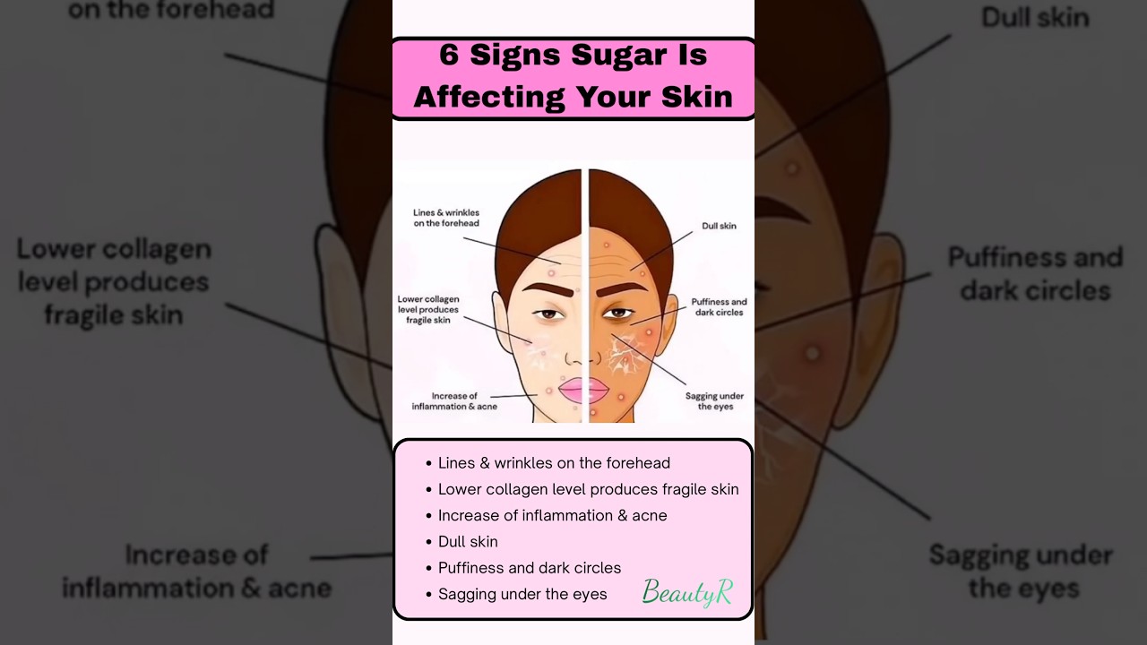 6 signs sugar is affecting your 